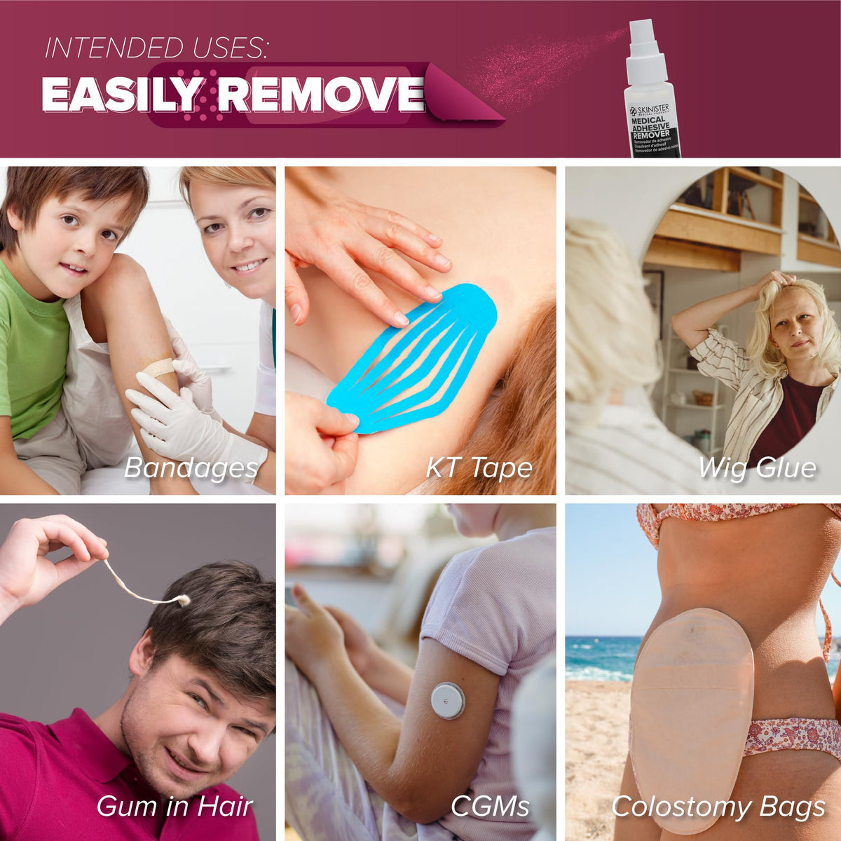 Adhesive Remover Wipes 50 Dry Wipes + 2oz Spray Solution Z226